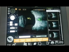 IOLの計算機能超音波走査器機械10MHz高い極度の軸決断