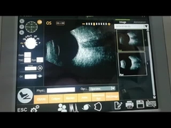 ファン スキャンBスキャン機械10MHz網膜の取り外しを観察する