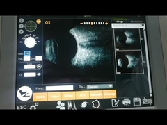 Bの超音波走査器機械電磁石のガラス質 ボディ病気の検査