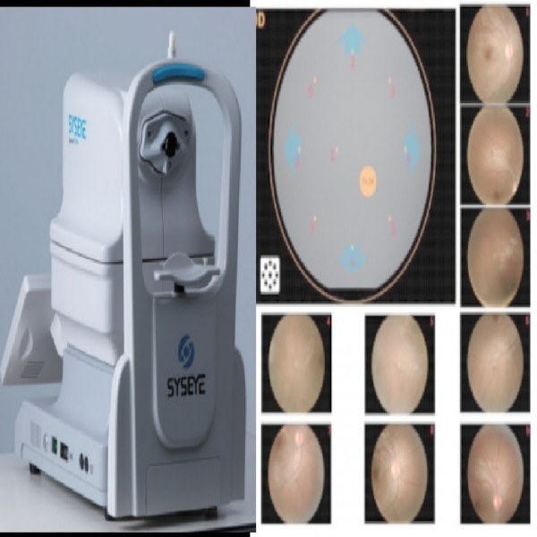 2.8mm 瞳孔 DICOM & AI マニュアルフォーカス付きの携帯型非ミドリアティック網膜カメラ