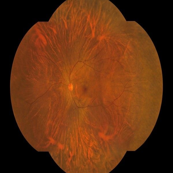 8μm 光学解像度 広場 fundus カメラ 27インチ HD カラーモニターと眼科診断用の自動フォーカス